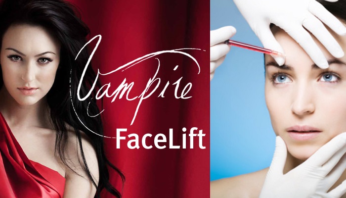Vampir Facelift