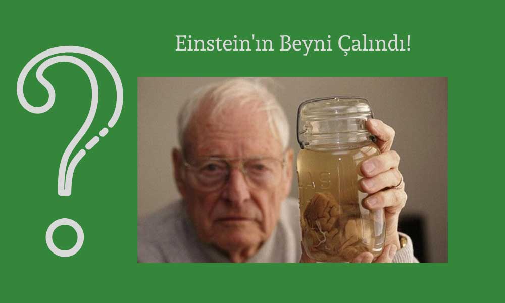Albert Einstein’in Beynine Ne Oldu?