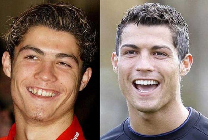 Unlu Futbolcularin Eski Ve Yeni Halleri Cristiano Ronaldo