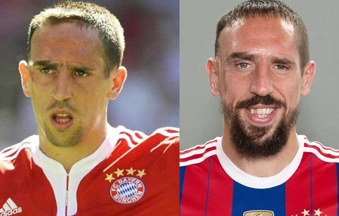 Unlu Futbolcularin Eski Ve Yeni Halleri Franck Ribery
