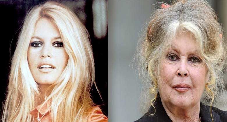 Unlulerin Genclik Ve Yaslilik Halleri Brigitte Bardot 35