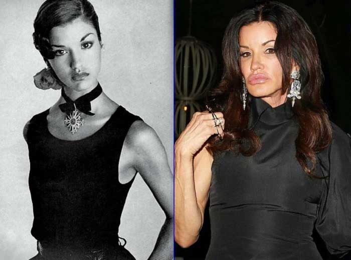 Unlulerin Genclik Ve Yaslilik Halleri Janice Dickinson 70