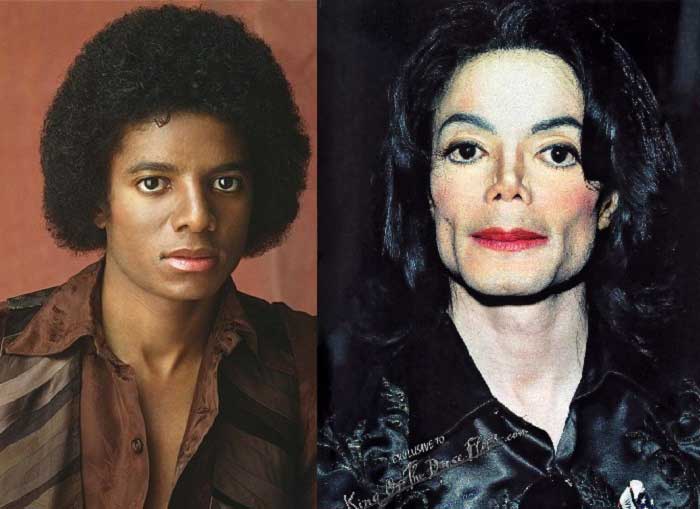 Unlulerin Genclik Ve Yaslilik Halleri Michael Jackson