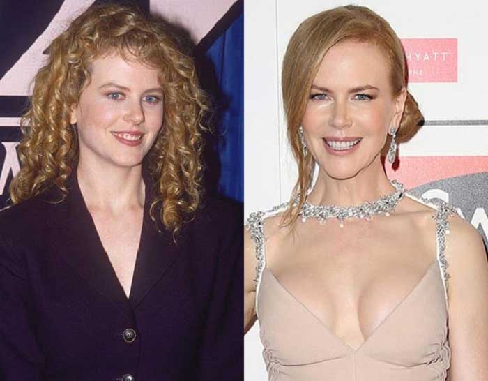 Unlulerin Genclik Ve Yaslilik Halleri Nicole Kidman 87
