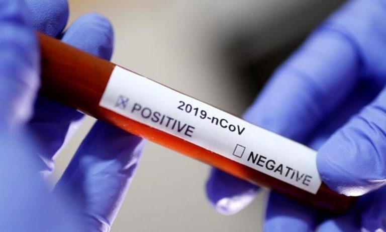 Koronavirüs Nedeniyle Hayatını Kaybedenlerin Sayısı 500’ü Aşarken, Güvenli Varlıklara Talep Arttı
