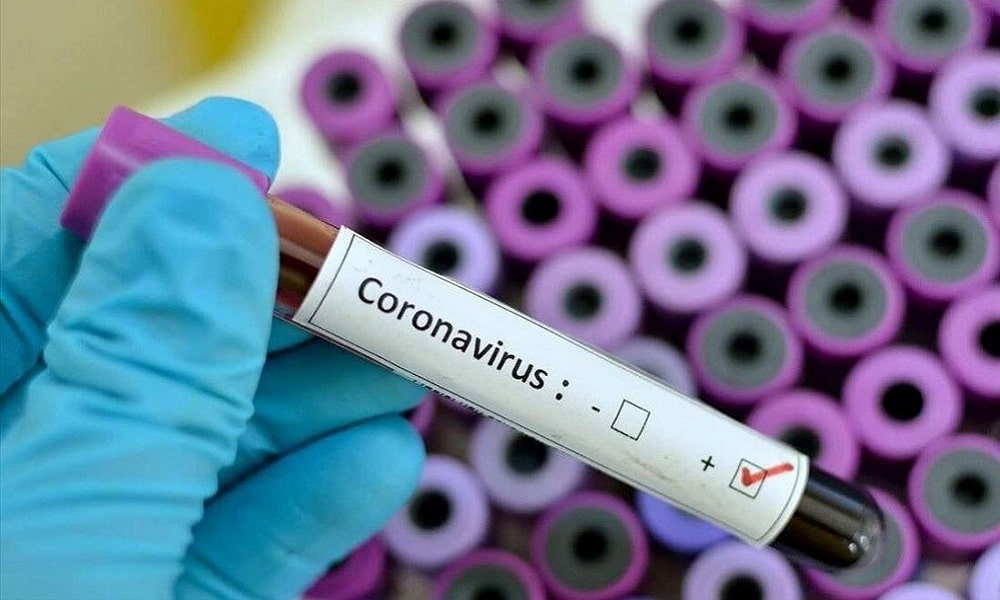 Coronathon Etkinliği