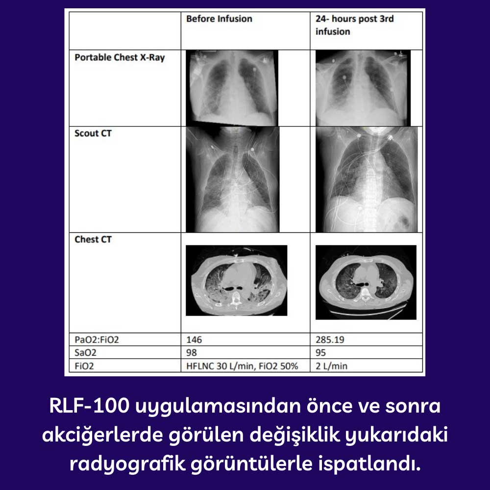 RLF-100 Uygulaması Öncesi ve Sonrası RLF-100 Uygulaması Öncesi ve Sonrası