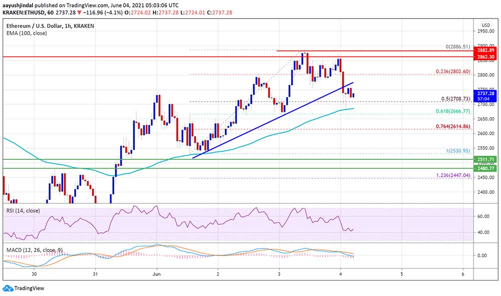 ETH 2.600 dolara geriledi ETH 2.600 dolara geriledi