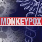 ABD’de Maymun Çiçeği Vakaları Haftalık Bazda İkiye Katlandı