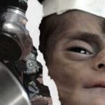 BM Duyurdu: Küresel Bilanço Ağır, Dünyanın Yüzde 10’u Aç!