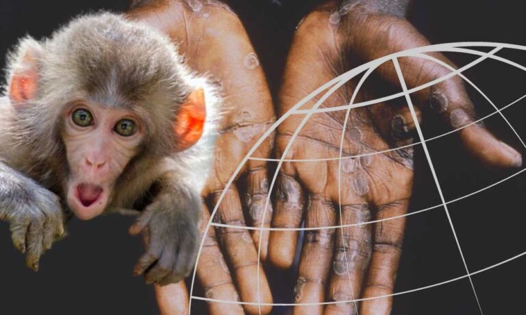 Avusturalya İlan Etti: Maymun Çiçeği Ulusal Bulaşıcı Hastalık!