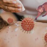 DSÖ: Maymun Çiçeği için Küresel Acil Durum Kararı