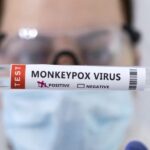 ABD’de Acil Durum İlanı: Maymun Çiçeği Alarmı Verildi