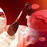 Maymun Çiçeği Virüsü Belirtileri Ne? Türkiye’de Var mı?