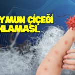 Polyester Şirketinden Maymun Çiçeği Yorumu: Bize Olumlu Yansır!