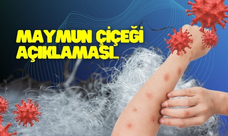 Polyester Şirketinden Maymun Çiçeği Yorumu: Bize Olumlu Yansır!