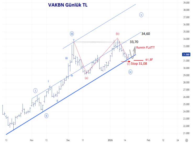 VAKBN teknik görünüm